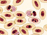 Plasmodium relictum